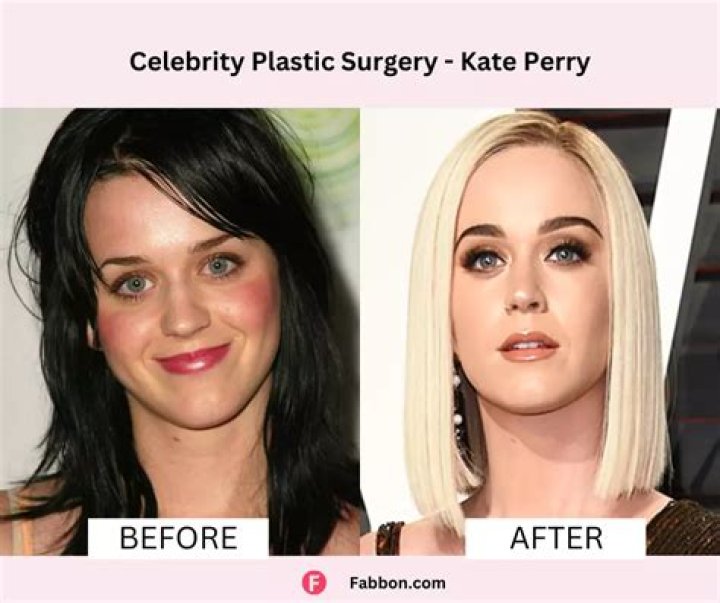 Chloe Bridges Plastic Surgery Before and After
