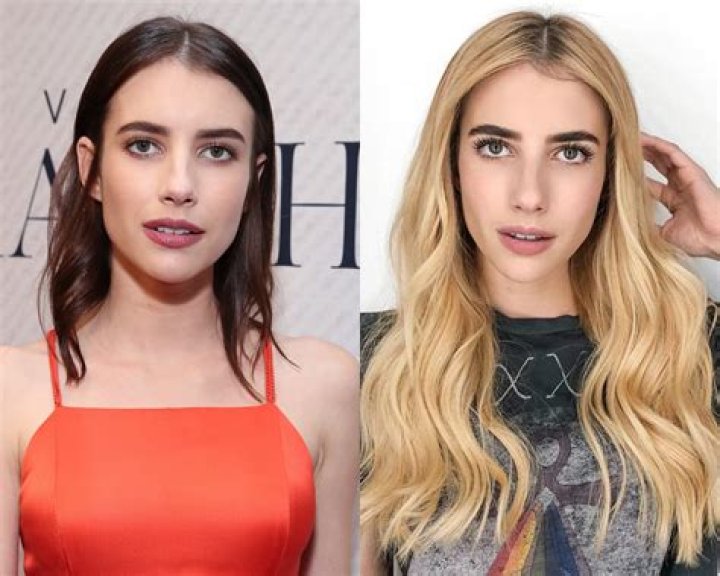 Emma Roberts Plastic Surgery Before and After