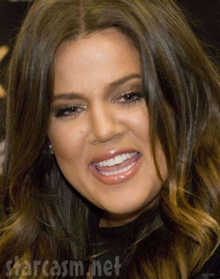Khloe Kardashian Gets Invisalign Braces On Her Teeth – Kris Jenner Wants Daughter Perfect! Khloe Kardashian Gets Invisalign Braces On Her Teeth – Kris Jenner Wants Daughter Perfect!